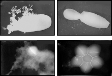 למעלה: תאי שמר (Candida albicans) למטה: חיידק (Staphylococcus Aureus). מימין: לפני הטיפול בליפו-פפטיד סינתטי. משמאל: אחרי הטיפול. הצילומים, שנעשו במיקרוסקופ-אלקטרונים, מראים את הנזק שנגרם לקרום התא 